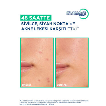 Bioderma Sebium Kerato+ Akne Eğilimli Ciltler İçin Jel Krem 30 ml PUANSIZDIR - 5