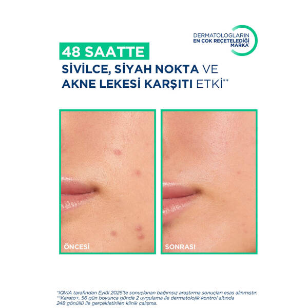 Bioderma Sebium Kerato+ Akne Eğilimli Ciltler İçin Jel Krem 30 ml PUANSIZDIR - 5