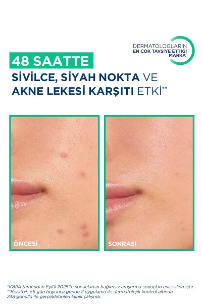 Bioderma Sebium Kerato+ Akne Eğilimli Ciltler İçin Jel Krem 30 ml PUANSIZDIR - 4