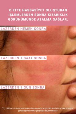 Etat Pur Pure Active Enoksolon %2 Saf Konsantre Bakım 15 ml - 4