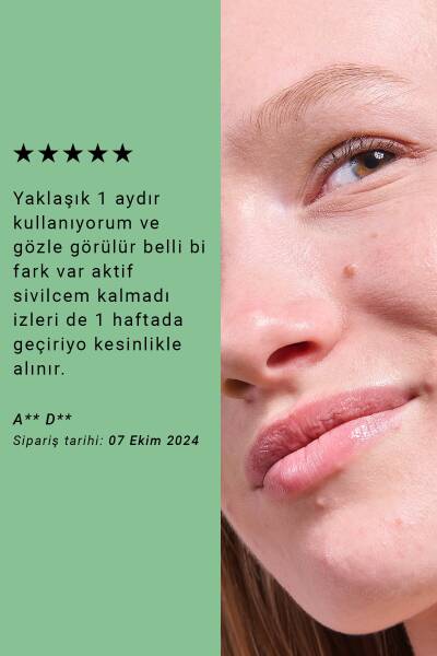 Etat Pur Pure Active Propolis Siyah Nokta Görünümüne Karşı Saf Konsantre Bakım 15 ml - 7