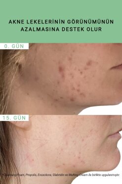 Etat Pur Pure Active Propolis Siyah Nokta Görünümüne Karşı Saf Konsantre Bakım 15 ml - 10