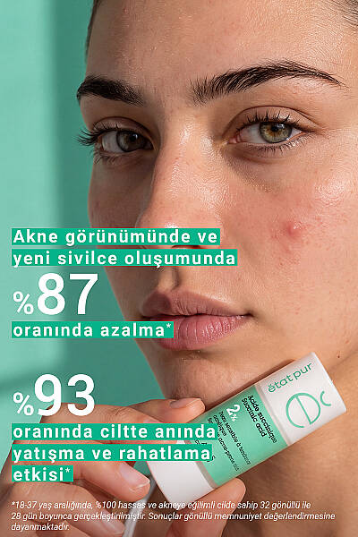 Etat Pur Pure Active Süksinik Asit %2 Hassas Ciltler için Akne ve Leke Karşıtı Konsantre Bakım Serumu 15 ml - 5