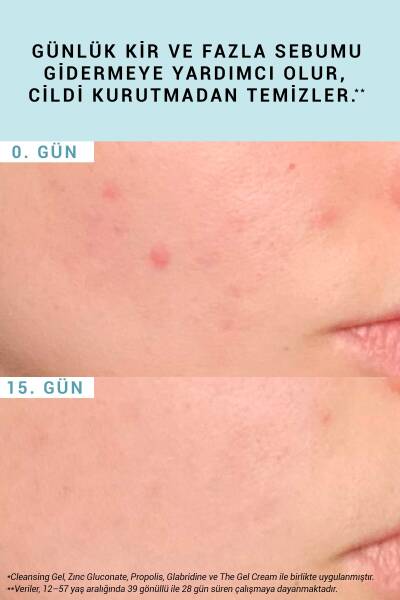 Etat Pur The Cleansing Gel - Arındırıcı Yüz Yıkama Jeli 200 ml - 3